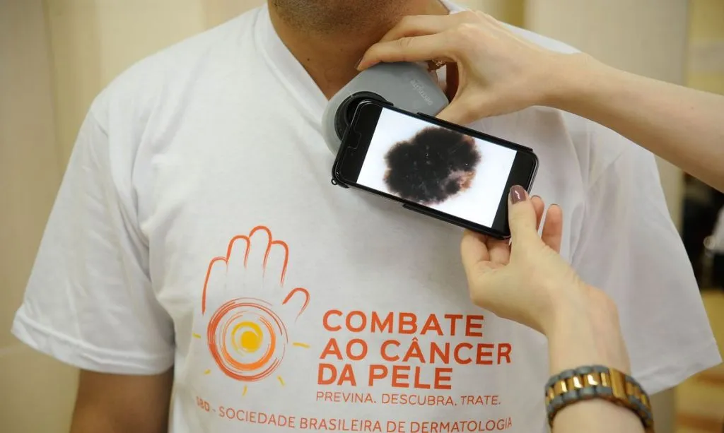 Pacientes são examinados durante campanha do Dia Nacional de Combate ao Câncer de Pele no Hospital Federal de Ipanema.(Fernando Frazão/Agência Brasil)