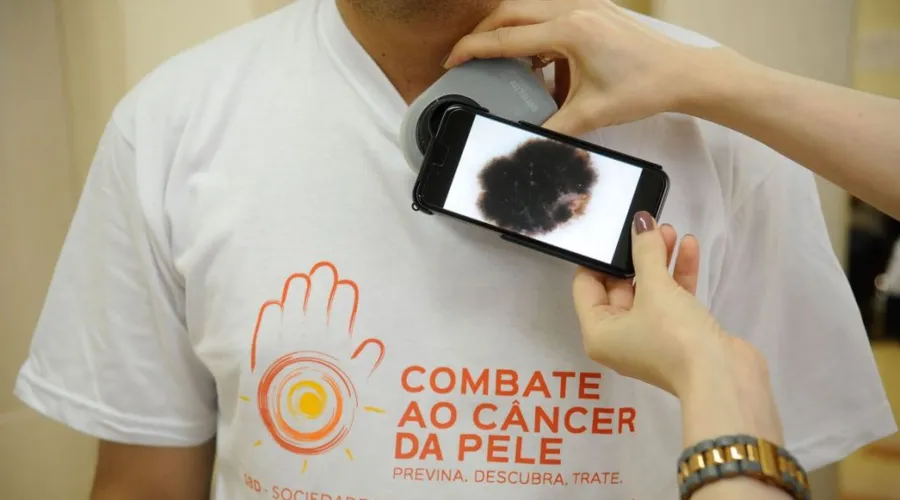 Pacientes são examinados durante campanha do Dia Nacional de Combate ao Câncer de Pele no Hospital Federal de Ipanema.(Fernando Frazão/Agência Brasil)