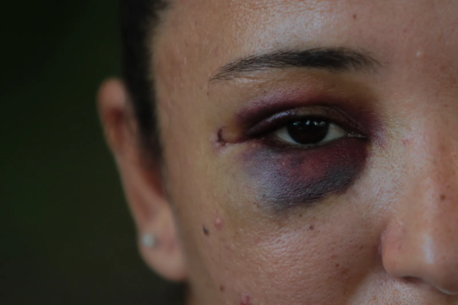 Imagem ilustrativa da imagem Gritaria e agressão entre policiais e um casal em São Gonçalo