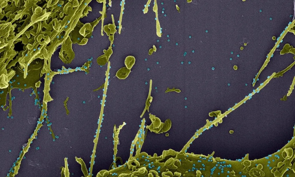 Imagem ilustrativa da imagem França investiga nova variante do coronavírus que escapa a teste PCR