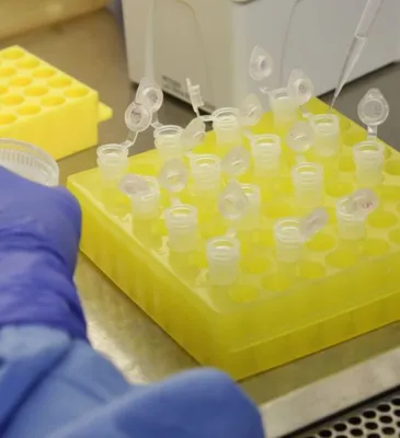 Diagnóstico laboratorial de casos suspeitos do novo coronavírus (2019-nCoV), realizado pelo Laboratório de Vírus Respiratório e do Sarampo do Instituto Oswaldo Cruz (IOC/Fiocruz), que atua como Centro de Referência Nacional em Vírus Respiratórios para o Ministério da Saúde
