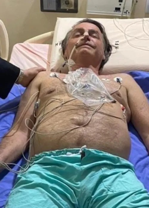 Imagem ilustrativa da imagem Bolsonaro pode passar por nova cirurgia de emergência