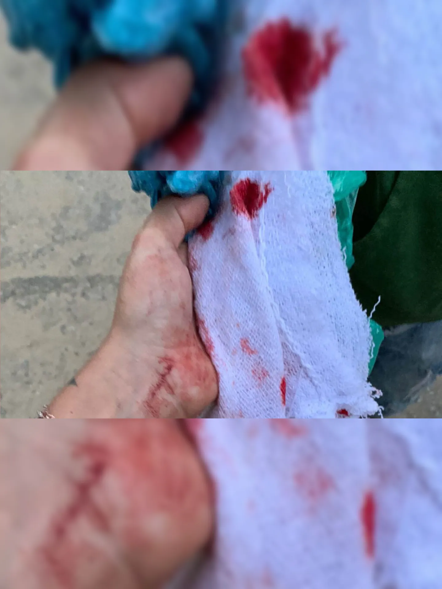 Imagem ilustrativa da imagem Proprietária de bar em Angra dos Reis é agredida com socos